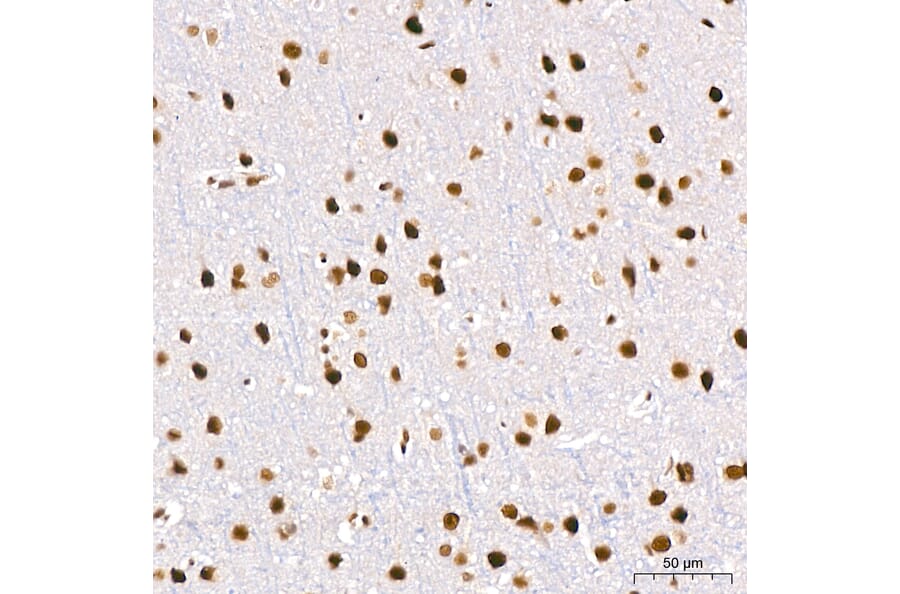 Immunohistochemistry - Anti-DBC-1 Antibody (A329309) - Antibodies.com