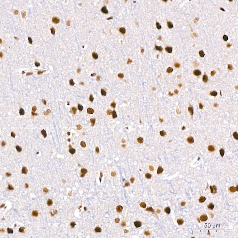 Immunohistochemistry - Anti-DBC-1 Antibody (A329309) - Antibodies.com