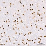 Immunohistochemistry - Anti-DBC-1 Antibody (A329309) - Antibodies.com