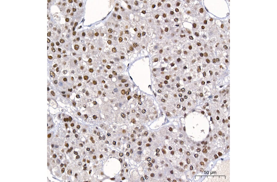 Immunohistochemistry - Anti-DBC-1 Antibody (A329309) - Antibodies.com