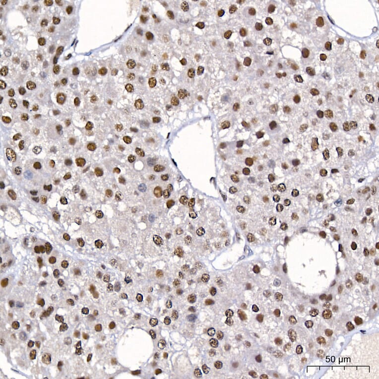 Immunohistochemistry - Anti-DBC-1 Antibody (A329309) - Antibodies.com