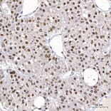 Immunohistochemistry - Anti-DBC-1 Antibody (A329309) - Antibodies.com