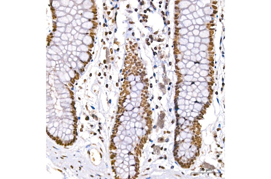 Immunohistochemistry - Anti-DBC-1 Antibody (A329309) - Antibodies.com