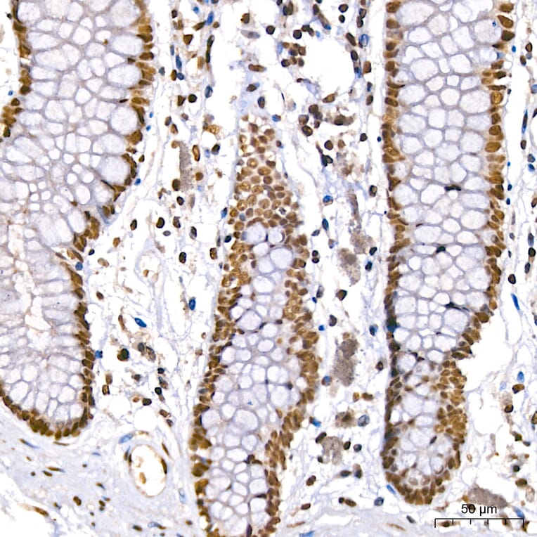 Immunohistochemistry - Anti-DBC-1 Antibody (A329309) - Antibodies.com
