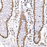 Immunohistochemistry - Anti-DBC-1 Antibody (A329309) - Antibodies.com