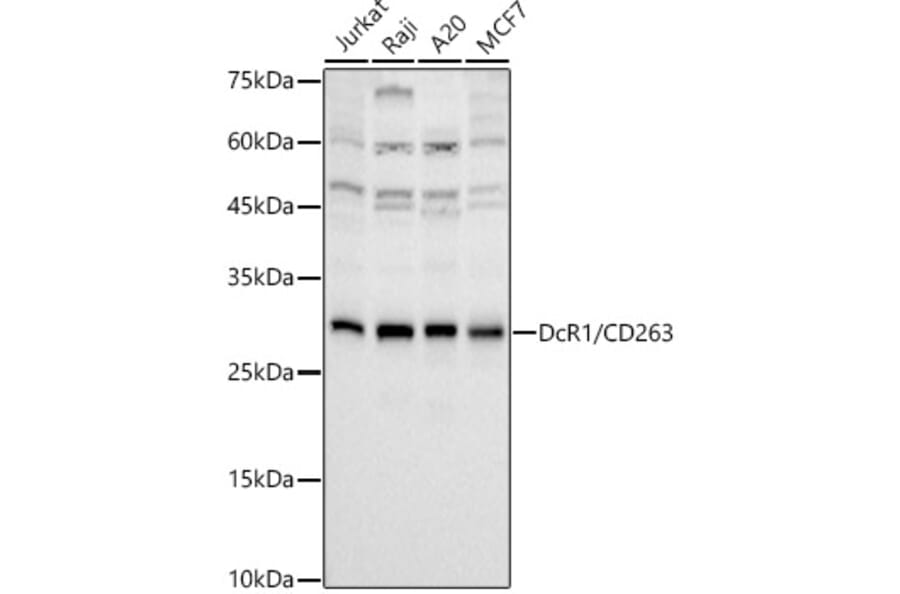 Western Blot - Anti-DcR1 Antibody [ARC3107] (A329310) - Antibodies.com