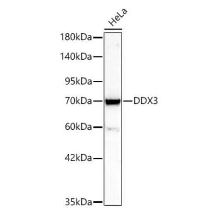 Western Blot - Anti-DDX3 Antibody (A329311) - Antibodies.com