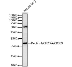 Western Blot - Anti-Dectin-1 Antibody (A329312) - Antibodies.com