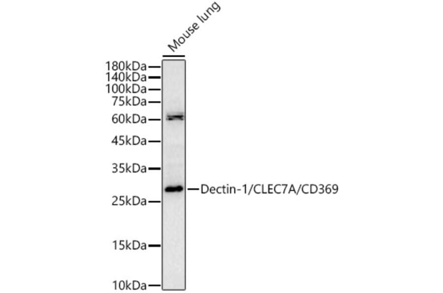 Western Blot - Anti-Dectin-1 Antibody (A329312) - Antibodies.com