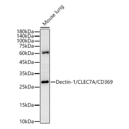 Western Blot - Anti-Dectin-1 Antibody (A329312) - Antibodies.com