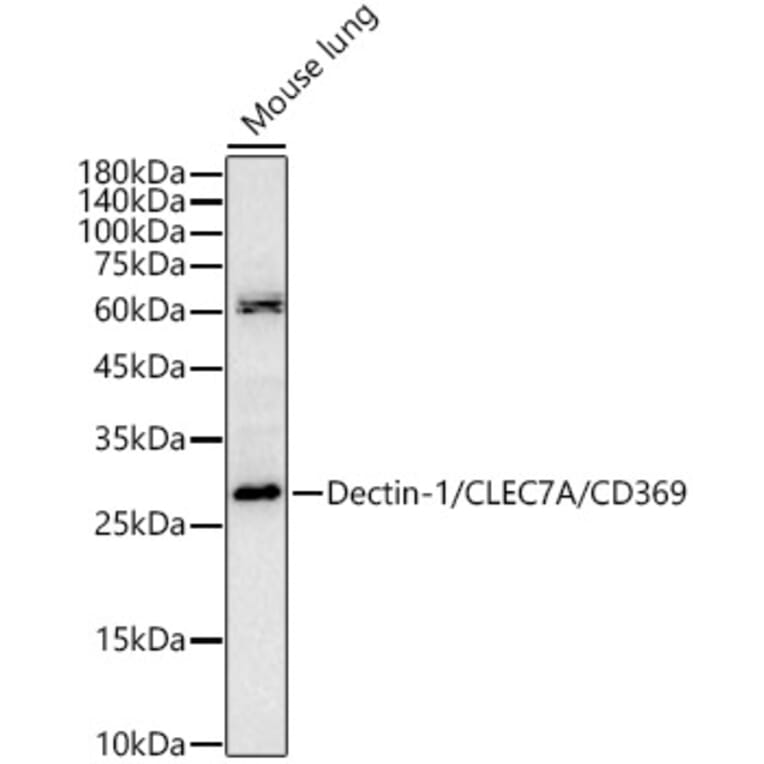Western Blot - Anti-Dectin-1 Antibody (A329312) - Antibodies.com