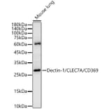 Western Blot - Anti-Dectin-1 Antibody (A329312) - Antibodies.com