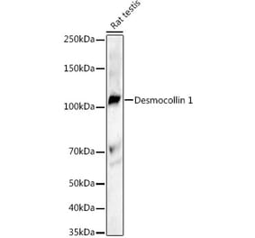 Western Blot - Anti-Desmocollin 1 Antibody [ARC3133] (A329313) - Antibodies.com