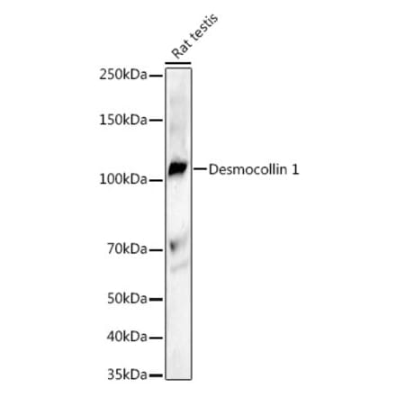 Western Blot - Anti-Desmocollin 1 Antibody [ARC3133] (A329313) - Antibodies.com
