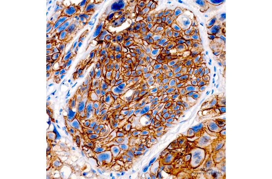 Immunohistochemistry - Anti-Desmoglein 3/PVA Antibody (A329314) - Antibodies.com