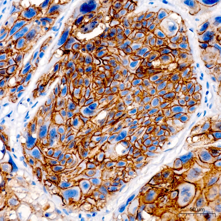 Immunohistochemistry - Anti-Desmoglein 3/PVA Antibody (A329314) - Antibodies.com