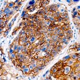Immunohistochemistry - Anti-Desmoglein 3/PVA Antibody (A329314) - Antibodies.com