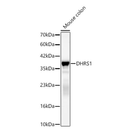 Western Blot - Anti-DHRS1 Antibody (A329317) - Antibodies.com