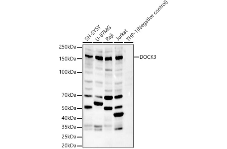 Western Blot - Anti-DOCK3 Antibody (A329321) - Antibodies.com