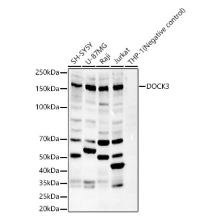 Western Blot - Anti-DOCK3 Antibody (A329321) - Antibodies.com