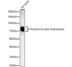 Western Blot - Anti-Dopamine beta Hydroxylase Antibody [ARC3095] (A329322) - Antibodies.com