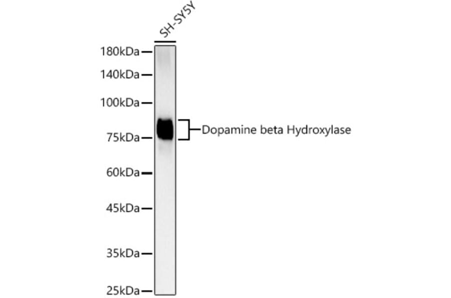 Western Blot - Anti-Dopamine beta Hydroxylase Antibody [ARC3095] (A329322) - Antibodies.com