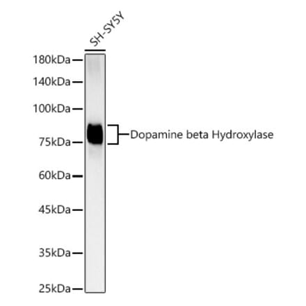 Western Blot - Anti-Dopamine beta Hydroxylase Antibody [ARC3095] (A329322) - Antibodies.com