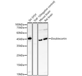 Western Blot - Anti-Doublecortin Antibody [ARC57902] (A329323) - Antibodies.com