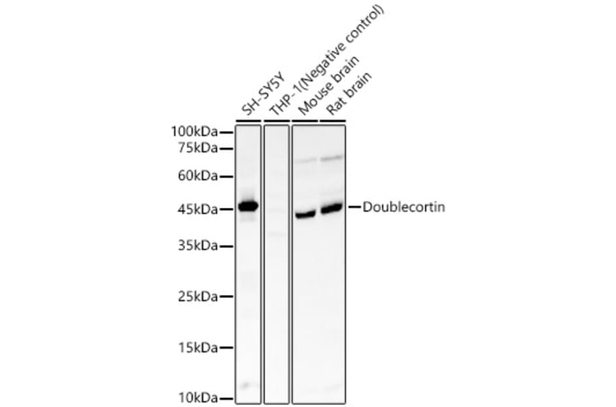 Western Blot - Anti-Doublecortin Antibody [ARC57902] (A329323) - Antibodies.com