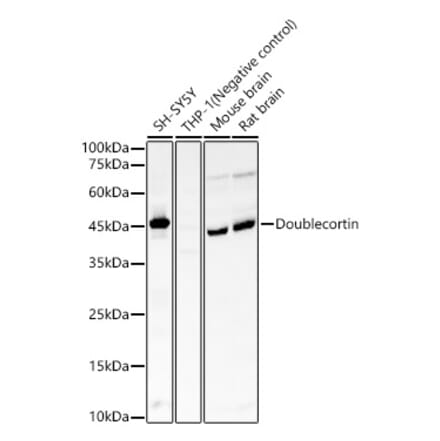 Western Blot - Anti-Doublecortin Antibody [ARC57902] (A329323) - Antibodies.com