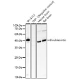 Western Blot - Anti-Doublecortin Antibody [ARC57902] (A329323) - Antibodies.com