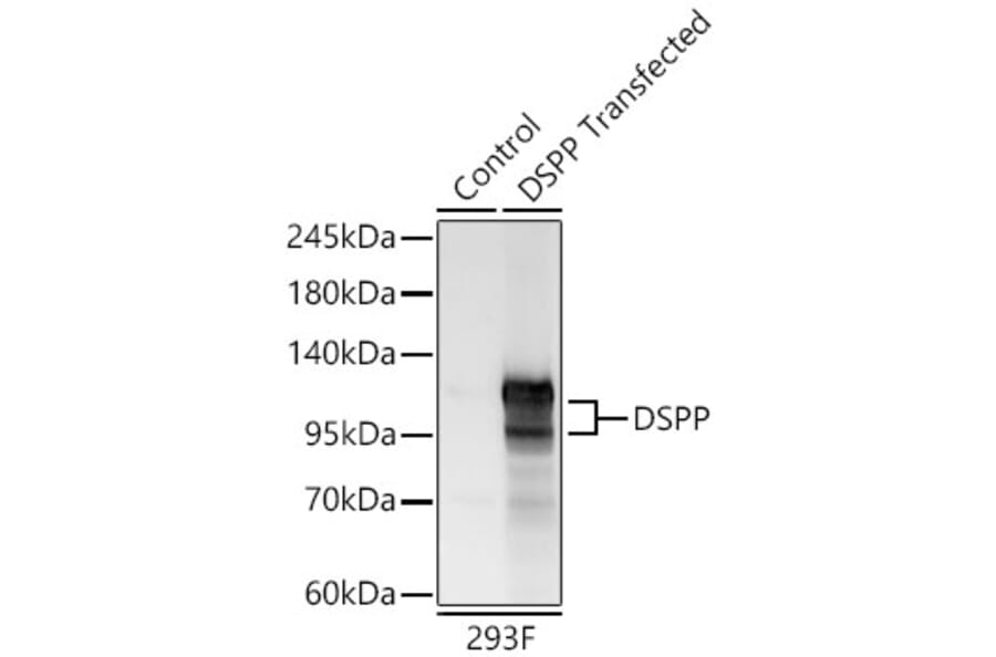 Western Blot - Anti-DSPP Antibody (A329324) - Antibodies.com