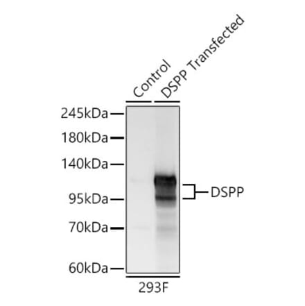 Western Blot - Anti-DSPP Antibody (A329324) - Antibodies.com