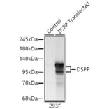 Western Blot - Anti-DSPP Antibody (A329324) - Antibodies.com
