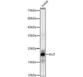 Western Blot - Anti-dUTPase Antibody [ARC3127] (A329326) - Antibodies.com