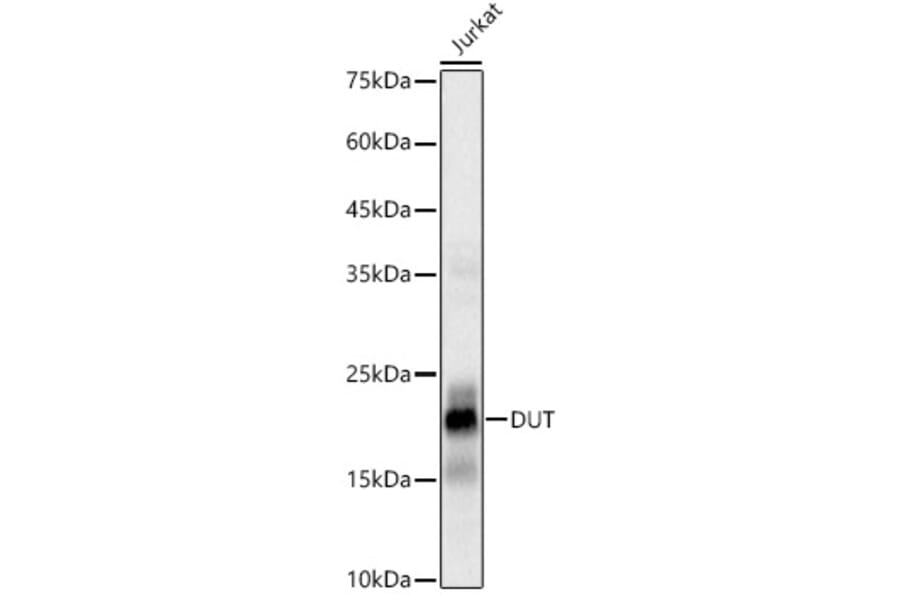 Western Blot - Anti-dUTPase Antibody [ARC3127] (A329326) - Antibodies.com