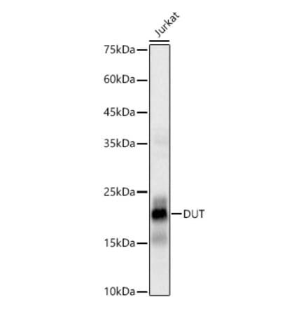 Western Blot - Anti-dUTPase Antibody [ARC3127] (A329326) - Antibodies.com