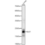 Western Blot - Anti-dUTPase Antibody [ARC3127] (A329326) - Antibodies.com