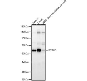 Western Blot - Anti-DYRK2 Antibody (A329329) - Antibodies.com