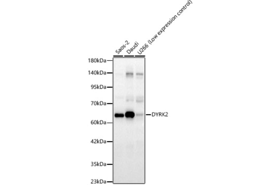 Western Blot - Anti-DYRK2 Antibody (A329329) - Antibodies.com