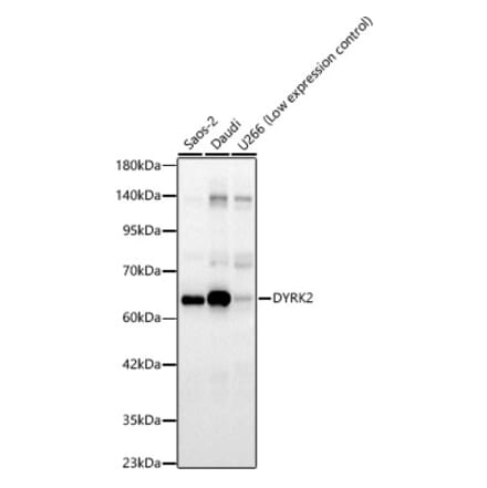 Western Blot - Anti-DYRK2 Antibody (A329329) - Antibodies.com