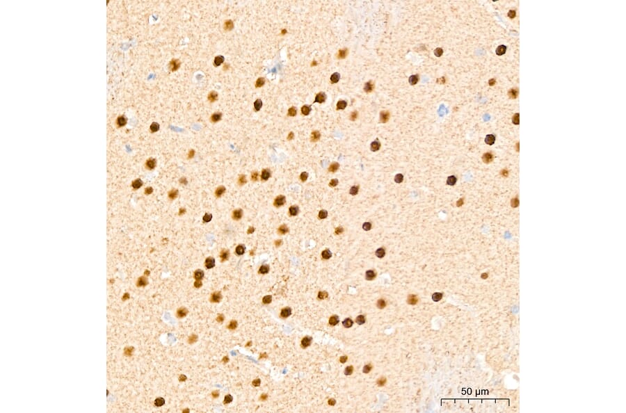Immunohistochemistry - Anti-DYRK2 Antibody (A329329) - Antibodies.com