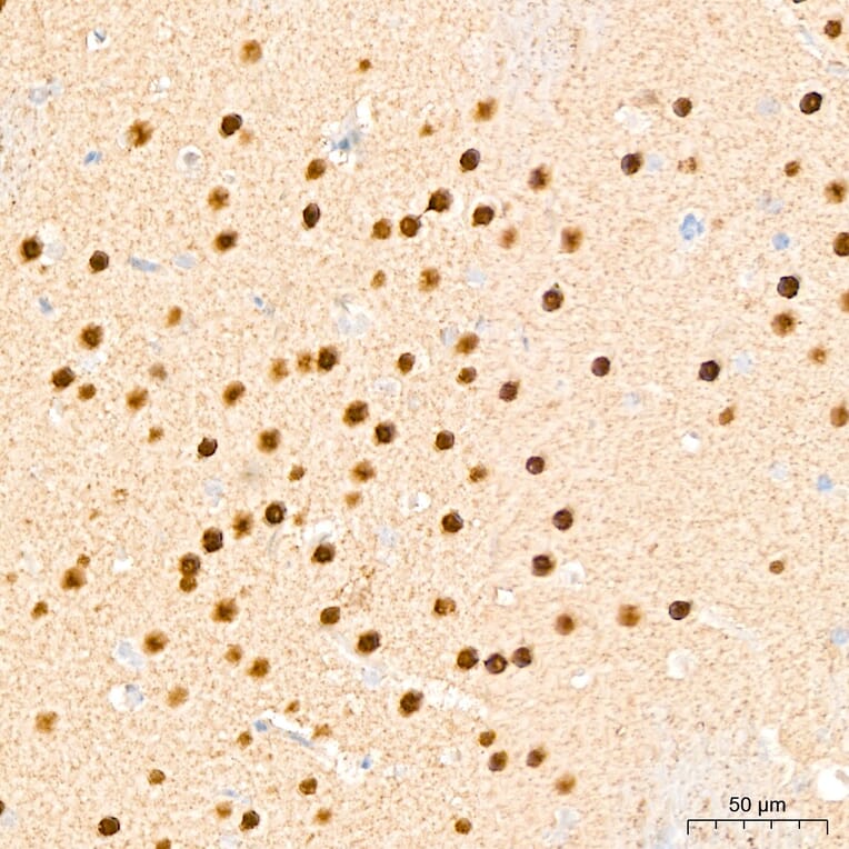 Immunohistochemistry - Anti-DYRK2 Antibody (A329329) - Antibodies.com