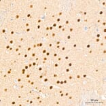 Immunohistochemistry - Anti-DYRK2 Antibody (A329329) - Antibodies.com