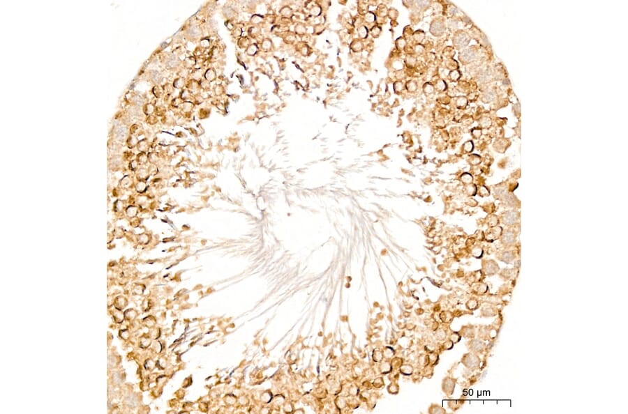 Immunohistochemistry - Anti-DYRK2 Antibody (A329329) - Antibodies.com