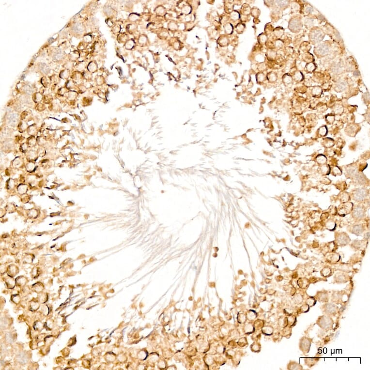 Immunohistochemistry - Anti-DYRK2 Antibody (A329329) - Antibodies.com