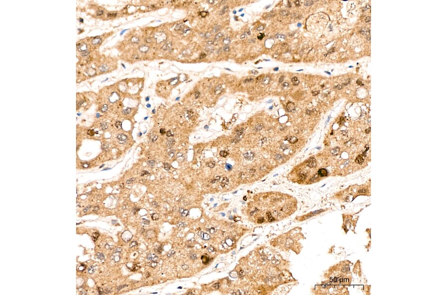 Immunohistochemistry - Anti-DYRK2 Antibody (A329329) - Antibodies.com