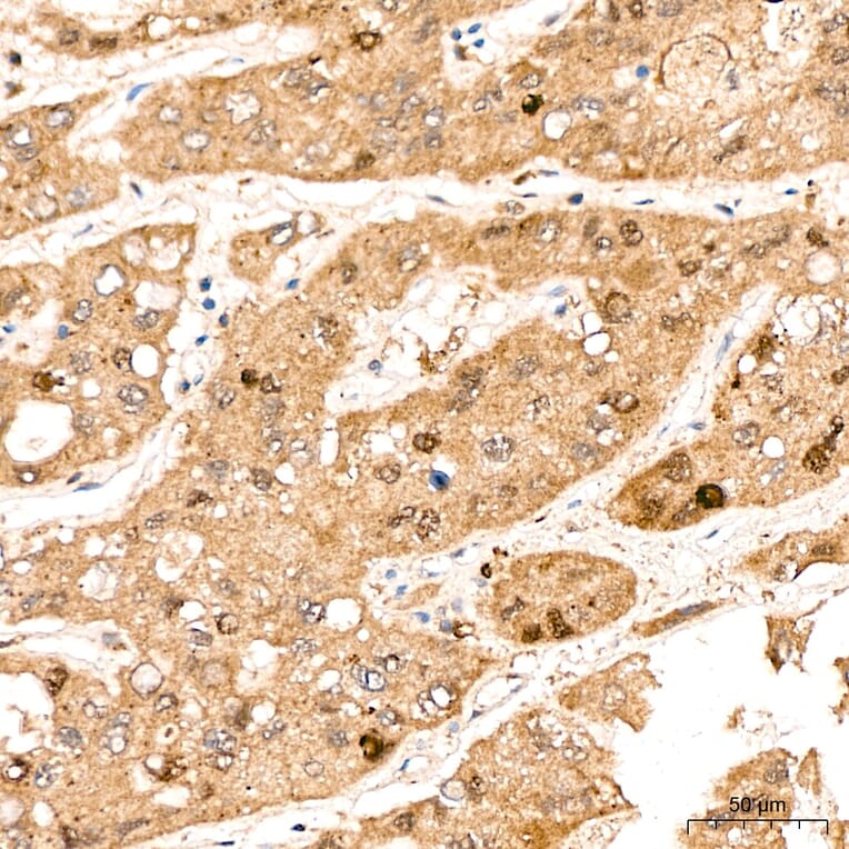 Immunohistochemistry - Anti-DYRK2 Antibody (A329329) - Antibodies.com