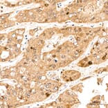 Immunohistochemistry - Anti-DYRK2 Antibody (A329329) - Antibodies.com