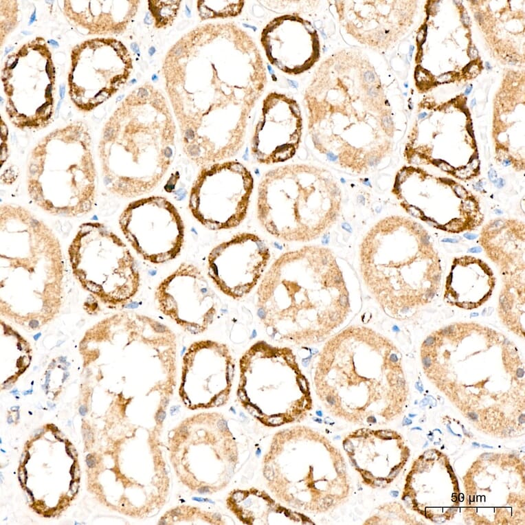 Immunohistochemistry - Anti-DYRK2 Antibody (A329329) - Antibodies.com